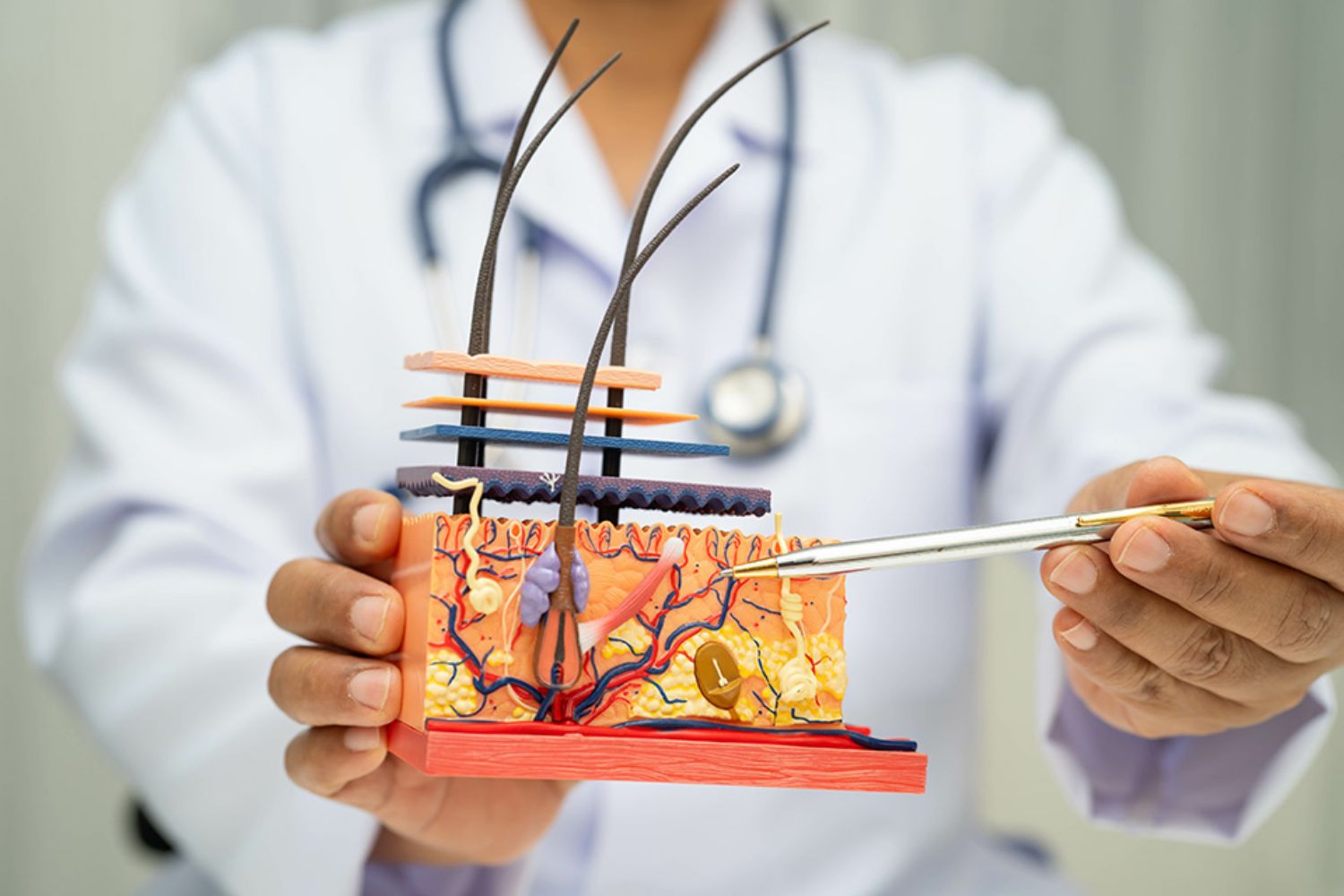 © kanruthai - stock.adobe.com Foto: Arzt zeigt mit Kugelschreiber auf Modell von Haarwurzel